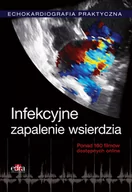 Książki medyczne - Echokardiografia Praktyczna Infekcyjne zapalenie wsierdzia - mamy na stanie, wyślemy natychmiast - miniaturka - grafika 1