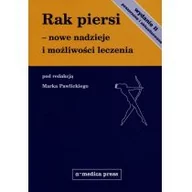 Książki medyczne - Alfa-Medica Press Rak piersi - nowe nadzieje i możliwości leczenia (II wyd.) - Marek Pawlicki - miniaturka - grafika 1