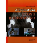 Książki medyczne - Alloplastyka stawu biodrowego - Andrzej Pozowski - miniaturka - grafika 1