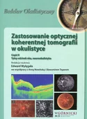 Książki medyczne - Zastosowanie optycznej koherentnej tomografii w okulistyce Czę$197ć 2 - miniaturka - grafika 1