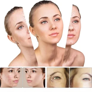 Urządzenie Darsonval Profesjonalne High Frequency System 30W - Pozostałe urządzenia kosmetyczne - miniaturka - grafika 4