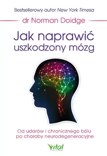 Jak naprawić uszkodzony mózg - E-booki - nauka - miniaturka - grafika 1