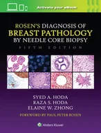Technika - Rosen's Diagnosis of Breast Pathology by Needle Core Biopsy - Hoda Syed A, Hoda Raza S., Elaine Zhong - miniaturka - grafika 1