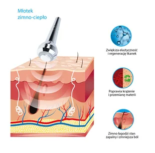 Alvi Prague Młotek ciepło zimno T-05 - Pozostałe urządzenia kosmetyczne Alvi Prague Młotek ciepło zimno T-05 - Pozostałe urządzenia kosmetyczne - miniaturka - grafika 8