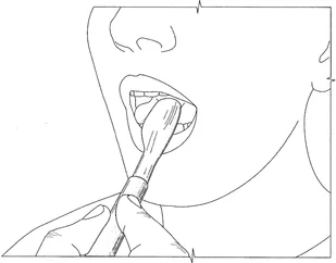 Spoon Tip XXL końcówka masująca do wibratora, do głoski R, (twarda guzkowata) - Akcesoria medyczne - miniaturka - grafika 4