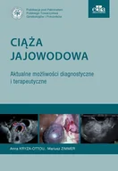 Książki medyczne - Ciąża jajowodowa Aktualne możliwości diagnostyczne i terapeutyczne | - miniaturka - grafika 1