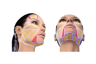 Alvi Prague Urządzenie HIFU Super-Lift - Pozostałe urządzenia kosmetyczne - miniaturka - grafika 2