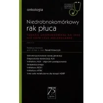 PZWL Niedrobnokomórkowy rak płuca Paweł Krawczyk - Nauka - miniaturka - grafika 1