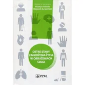 Książki medyczne - Ostre stany zagrożenia życia w obrażeniach ciała - miniaturka - grafika 1