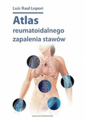 Książki medyczne - DK Media ATLAS REUMATOIDALNEGO ZAPALENIA STAWÓW - miniaturka - grafika 1