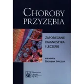 Książki medyczne - Wydawnictwo Lekarskie PZWL Choroby przyzębia - zapobieganie, diagnostyka, leczenie - Wydawnictwo Lekarskie PZWL - miniaturka - grafika 1