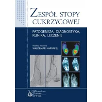 Zespół stopy cukrzycowej - Wydawnictwo Lekarskie PZWL - Zdrowie - poradniki - miniaturka - grafika 1