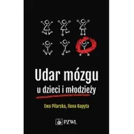 Biznes - Udar mózgu u dzieci i młodzieży | ZAKŁADKA DO KSIĄŻEK GRATIS DO KAŻDEGO ZAMÓWIENIA - miniaturka - grafika 1