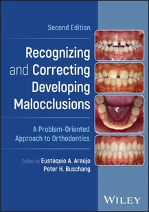 Recognizing and Correcting Developing Malocclusion s: A Problem-Oriented Approach to Orthodontics, Se cond Edition - Pozostałe książki - miniaturka - grafika 1
