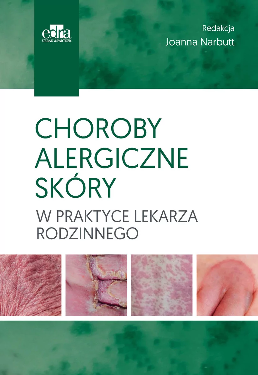 Urban &amp; Partner Choroby alergiczne skóry w praktyce lekarza rodzinnego