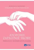 Książki medyczne - Atopowe zapalenie skóry. Podejście interdyscyplinarne - miniaturka - grafika 1