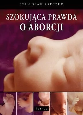 Szokująca prawda o aborcji - Rapczuk Stanisław