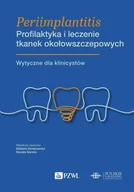 Książki medyczne - Periimplantitis. Profilaktyka i leczenie tkanek okołowszczepowych - miniaturka - grafika 1