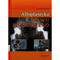 Książki medyczne - Alloplastyka stawu biodrowego - Andrzej Pozowski - miniaturka - grafika 1