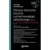 Książki medyczne - Obrazy kliniczne tocznia rumieniowatego układowego Część 2 - miniaturka - grafika 1