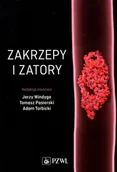 Książki medyczne - Zakrzepy i zatory - miniaturka - grafika 1