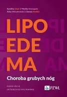 Książki medyczne - Lipoedema - Karolina Chęś, Monika Domagała, Artur Mieczkowski, Dorota Stettler - miniaturka - grafika 1