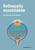 Książki medyczne - Retinopatia wcześniaków - Małgorzata Seroczyńska - miniaturka - grafika 1