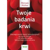 Twoje Badania Krwi Dlaczego Wyniki Badań Laboratoryjnych Są Często Błędne I Nie Odzwierciedlają Faktycznego Stanu Zdrowia Miryam Muhm - Zdrowie - poradniki - miniaturka - grafika 1
