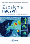 Książki medyczne - Zapalenia naczyń w praktyce klinicznej interdyscyplinarnie - miniaturka - grafika 1