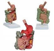 Mały naukowiec - MODEL ANATOMICZNY UKŁADU TRAWIENNEGO CZŁOWIEKA ŻOŁĄDEK JELITO PRZEŁYK - miniaturka - grafika 1