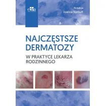 Najczęstsze dermatozy w praktyce lekarza rodzinnego - Książki medyczne - miniaturka - grafika 1