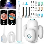 Pozostałe akcesoria kosmetyczne - Otoskop z kamerą BEBIRD Home 30S - miniaturka - grafika 1