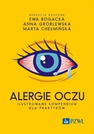 E-booki - nauka - Alergie oczu. Ilustrowane kompendium dla praktyków - miniaturka - grafika 1