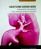 Książki medyczne - Cukrzycowa choroba nerek - miniaturka - grafika 1