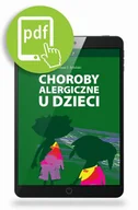 Książki medyczne - Choroby alergiczne u dzieci - dostępny od ręki, natychmiastowa wysyłka - miniaturka - grafika 1