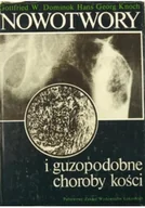 Książki medyczne - Nowotwory i guzopodobne choroby kości - miniaturka - grafika 1