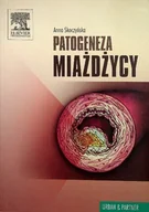 Książki medyczne - Patogeneza miażdżycy - miniaturka - grafika 1