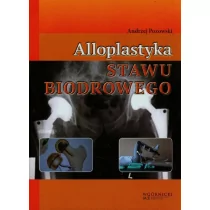 Alloplastyka stawu biodrowego - Andrzej Pozowski - Książki medyczne - miniaturka - grafika 1