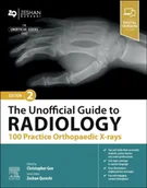 Pozostałe książki - The Unofficial Guide to Radiology: 100 Practice Orthopaedic X-rays - miniaturka - grafika 1