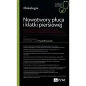 Książki medyczne - Nowotwory płuca i klatki piersiowej - miniaturka - grafika 1