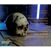 Archeologia - Album zmian kostnych średniowiecznej populacji z Gruczna - miniaturka - grafika 1