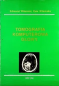 Książki medyczne - Tomografia komputerowa głowy - miniaturka - grafika 1