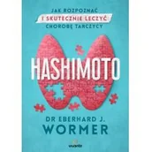 Zdrowie - poradniki - Hashimoto. Jak rozpoznać i skutecznie leczyć chorobę tarczycy - miniaturka - grafika 1