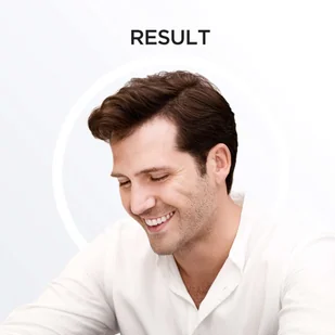 Nioxin Hair System 1 Kit W Kosmetyki Zestaw kosmetyków 150ml System 1 Cleanser Shampoo + 150ml System 1 Scalp Revitaliser Conditioner + 50ml System 1 Scalp Treatment 49229 - Zestawy kosmetyków damskich - miniaturka - grafika 3