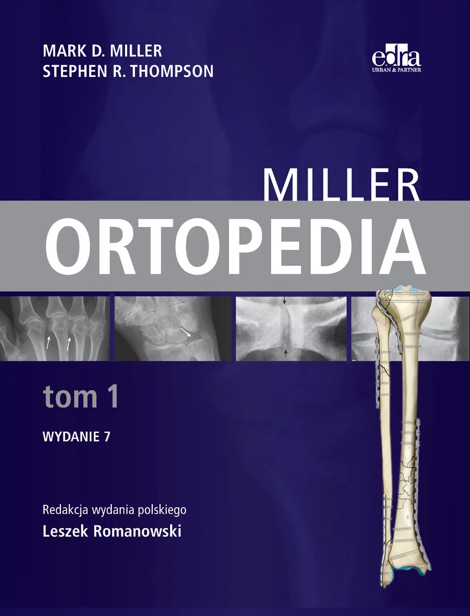 Ortopedia Miller Tom 1 M.D Miller S.R Thompson