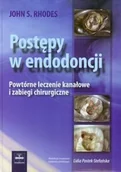 Książki medyczne - Postępy w endodoncji. Powtórne leczenie kanałowe i zabiegi chirurgiczne - miniaturka - grafika 1