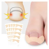 Akcesoria do paznokci - Plastry na wrastające paznokcie - 5 sztuk - miniaturka - grafika 1