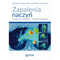 Zapalenia naczyń – w praktyce klinicznej interdyscyplinarnie: Diagnostyka i leczenie - Pozostałe książki - miniaturka - grafika 1