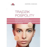 Książki medyczne - Edra Urban & Partner Trądzik pospolity - miniaturka - grafika 1