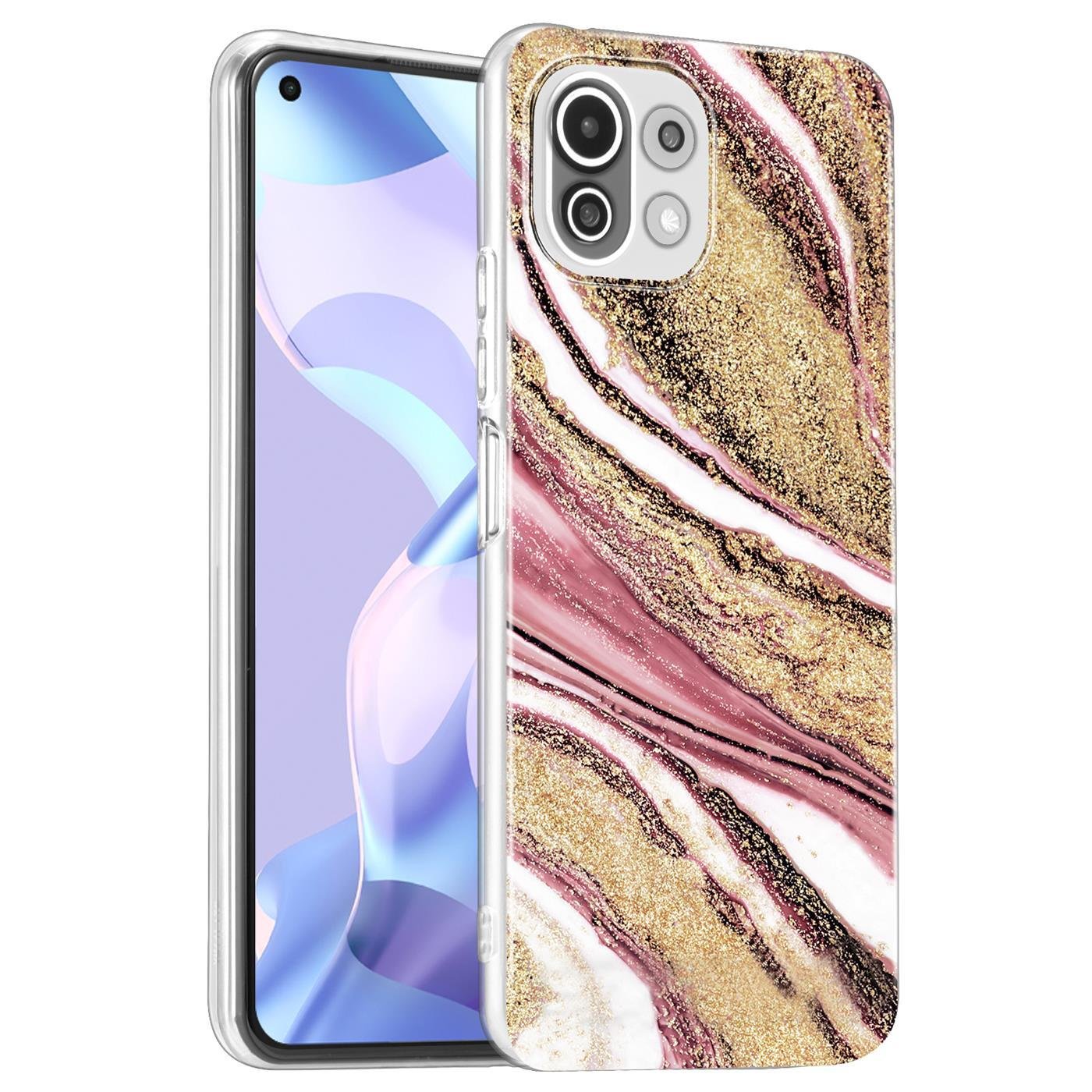 Etui na telefon Xiaomi Mi 11 Lite 4G/5G Protective Cover Marble Motif Silicone Slim Cover